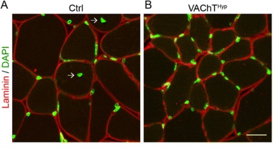 SKELETAL MUSCLES in DISEASES and AGING Image 1