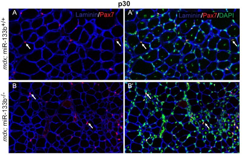 SKELETAL MUSCLES in DISEASES and AGING Image 2